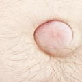 Hernia Treatment Options: What You Need to Know