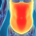 Understanding Chronic Constipation and Hernias